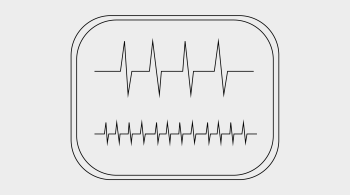 Home Respiratory Polygraphy